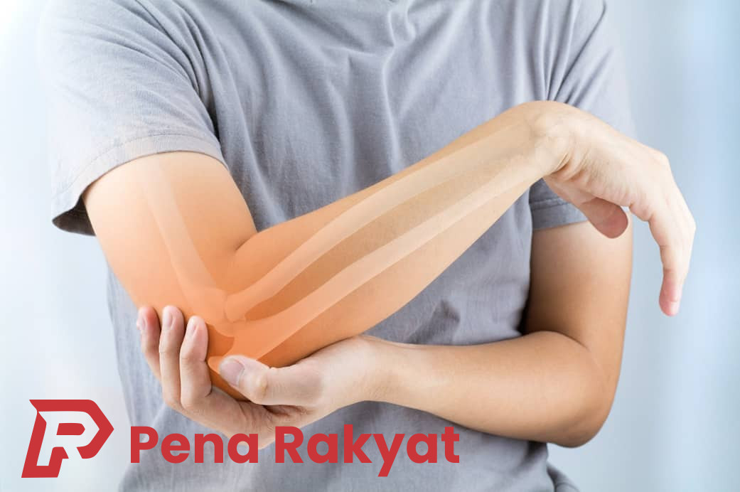 Panduan Pencegahan Tennis Elbow: RSUD Genteng Ajarkan Langkah-langkah Penting